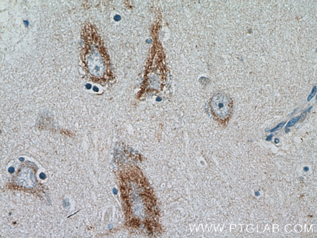 Immunohistochemistry (IHC) staining of human brain tissue using MC1R Polyclonal antibody (26471-1-AP)