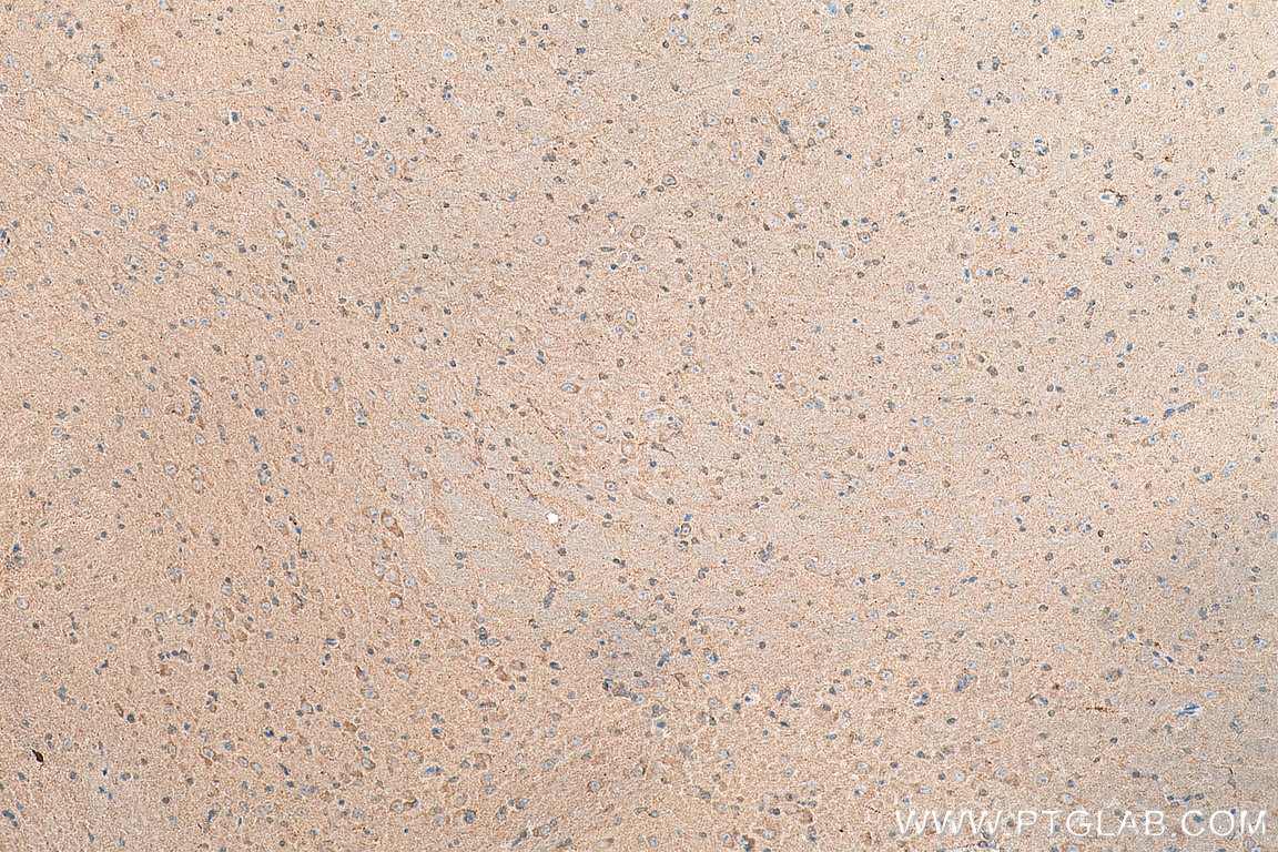 IHC staining of mouse brain using 21027-1-AP