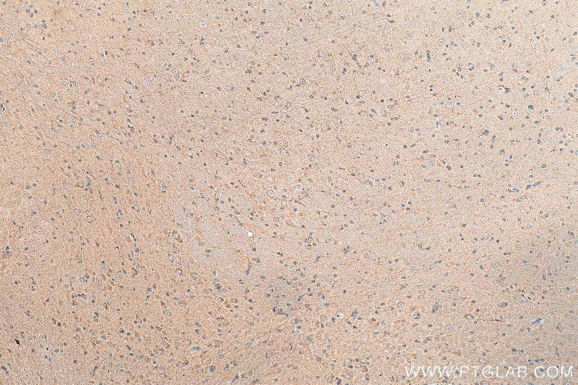 Immunohistochemistry (IHC) staining of mouse brain tissue using MC3R Polyclonal antibody (21027-1-AP)