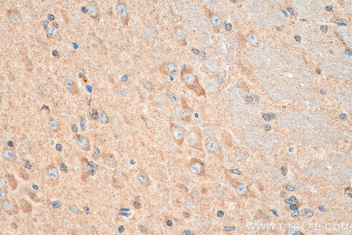Immunohistochemistry (IHC) staining of mouse brain tissue using MC3R Polyclonal antibody (21027-1-AP)