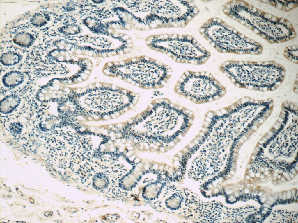 Immunohistochemistry (IHC) staining of human small intestine tissue using MC3R Polyclonal antibody (21027-1-AP)