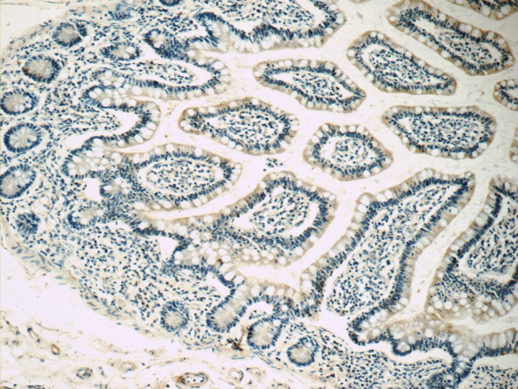 IHC staining of human small intestine using 21027-1-AP