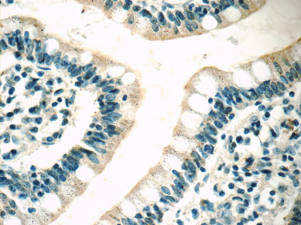 Immunohistochemistry (IHC) staining of human small intestine tissue using MC3R Polyclonal antibody (21027-1-AP)