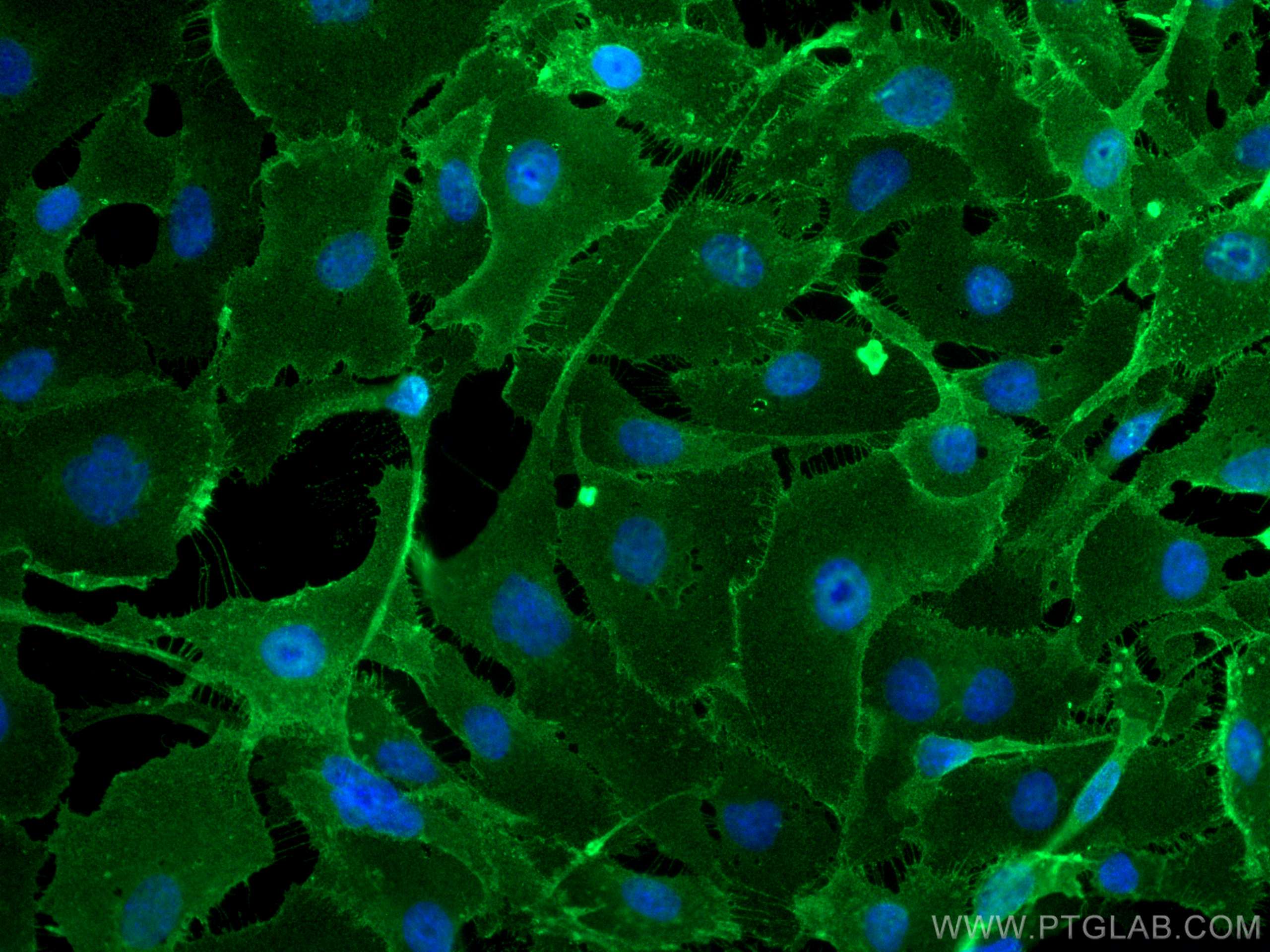 Immunofluorescence (IF) / fluorescent staining of HUVEC cells using CD146/MCAM Polyclonal antibody (17564-1-AP)