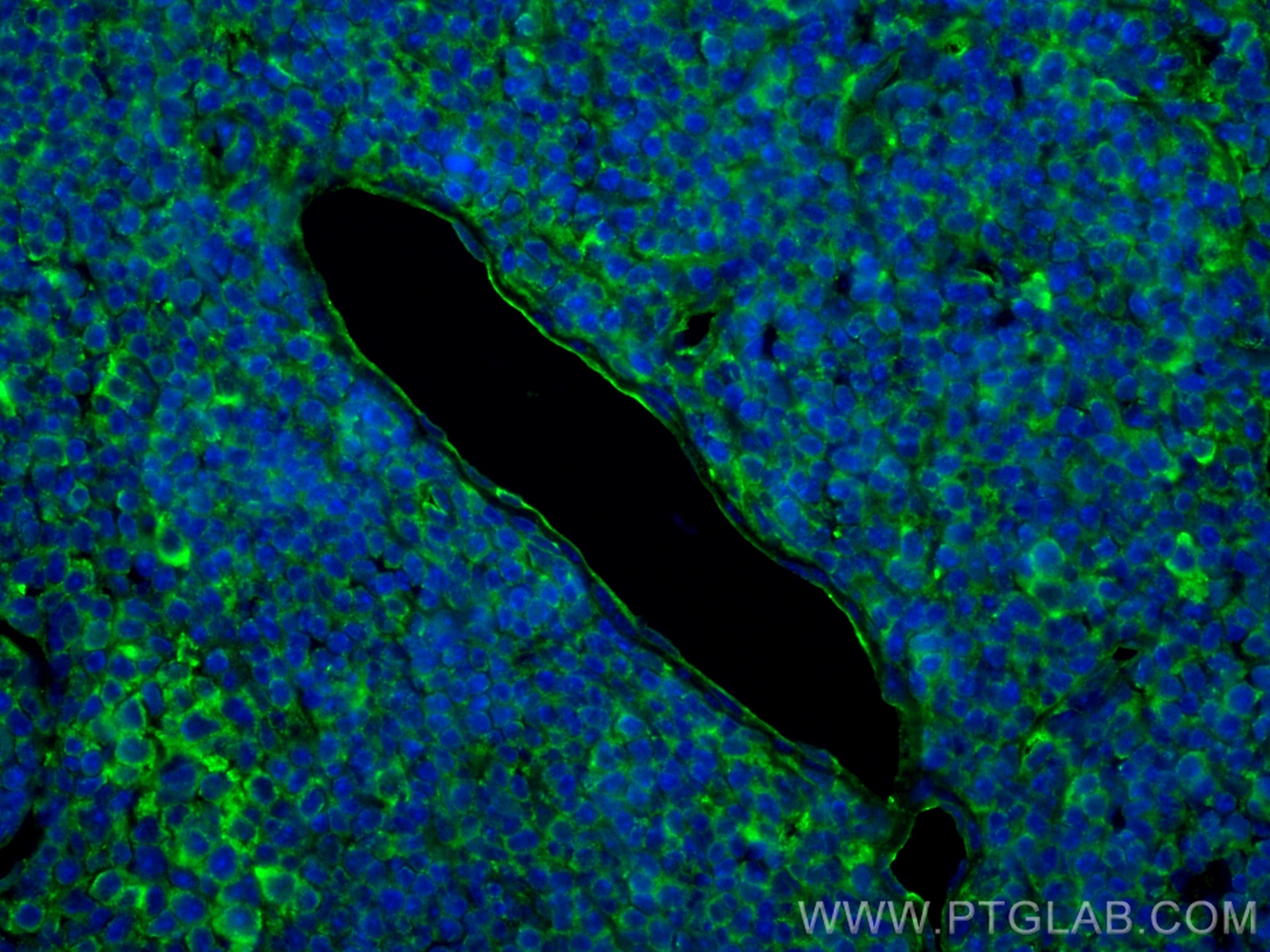 Immunofluorescence (IF) / fluorescent staining of mouse spleen tissue using CD146/MCAM Polyclonal antibody (17564-1-AP)