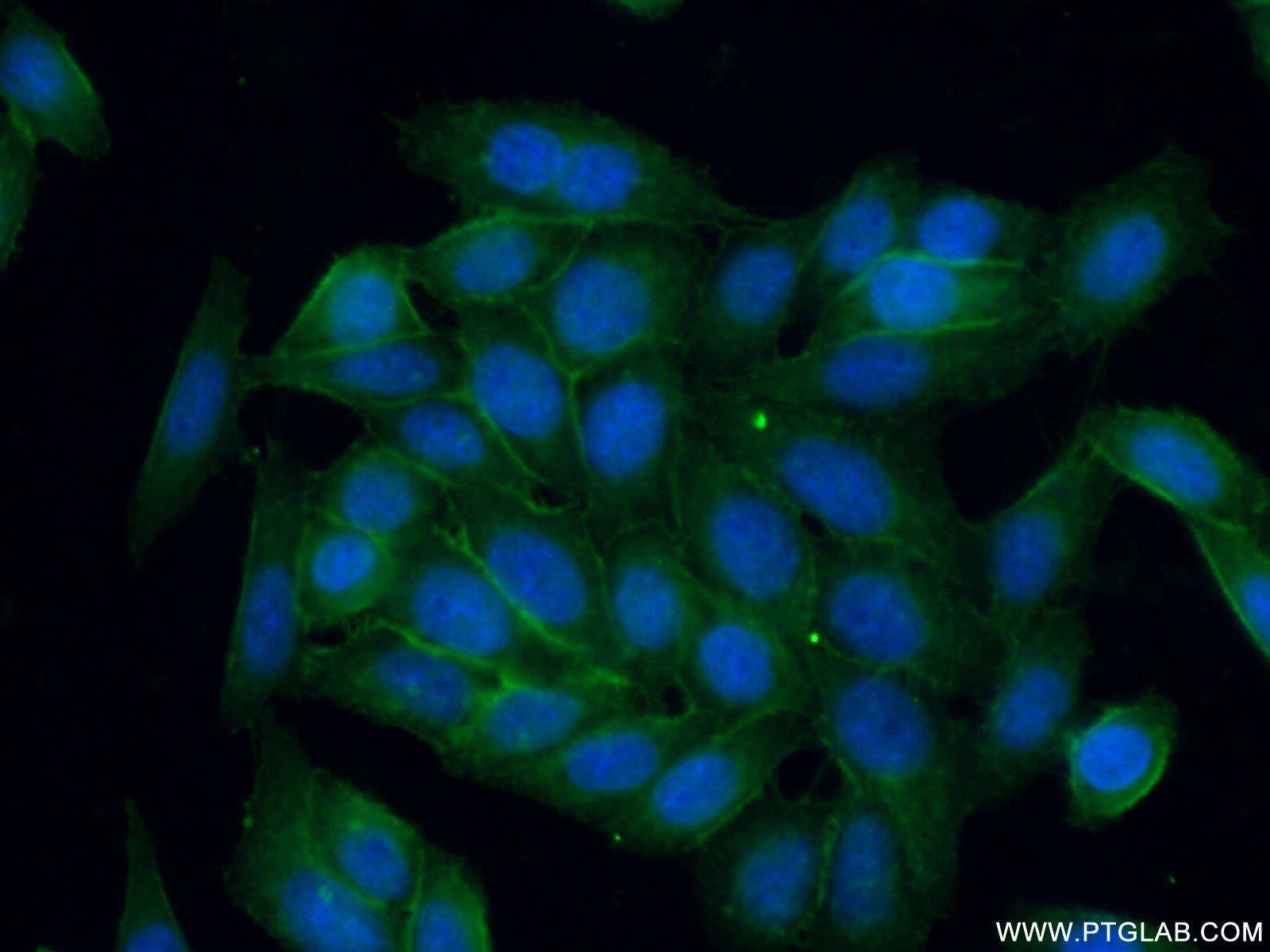 Immunofluorescence (IF) / fluorescent staining of HeLa cells using CD146/MCAM Polyclonal antibody (17564-1-AP)