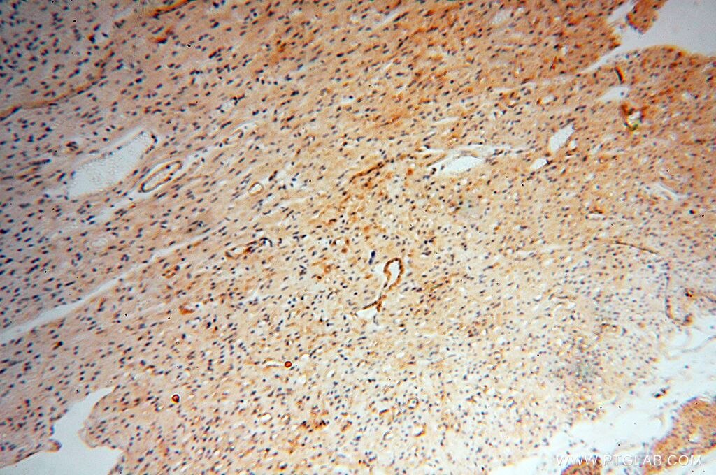 Immunohistochemistry (IHC) staining of human heart tissue using CD146/MCAM Polyclonal antibody (17564-1-AP)