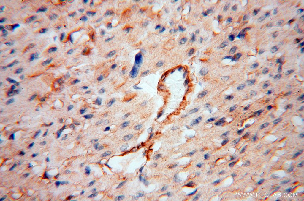Immunohistochemistry (IHC) staining of human heart tissue using CD146/MCAM Polyclonal antibody (17564-1-AP)