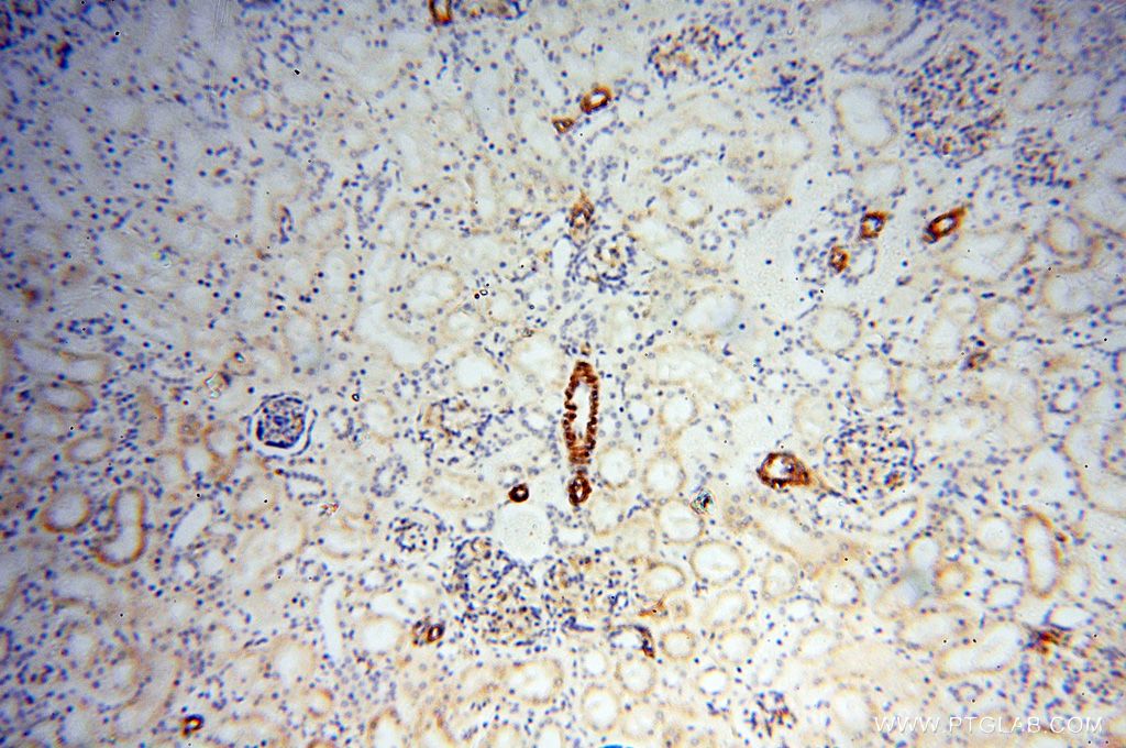 IHC staining of human kidney using 17564-1-AP