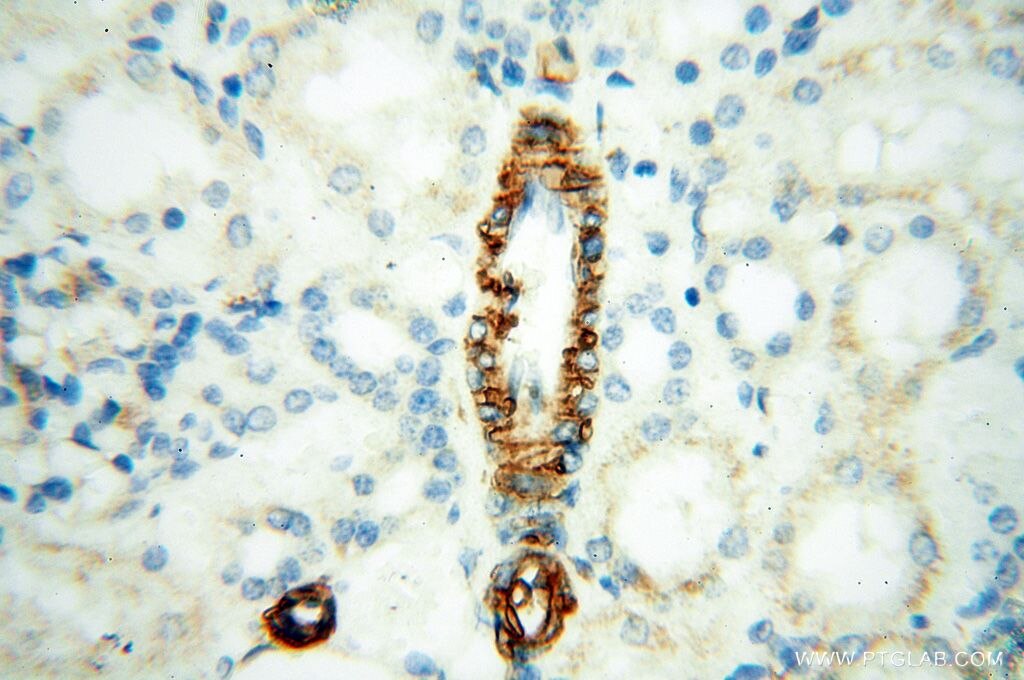 IHC staining of human kidney using 17564-1-AP