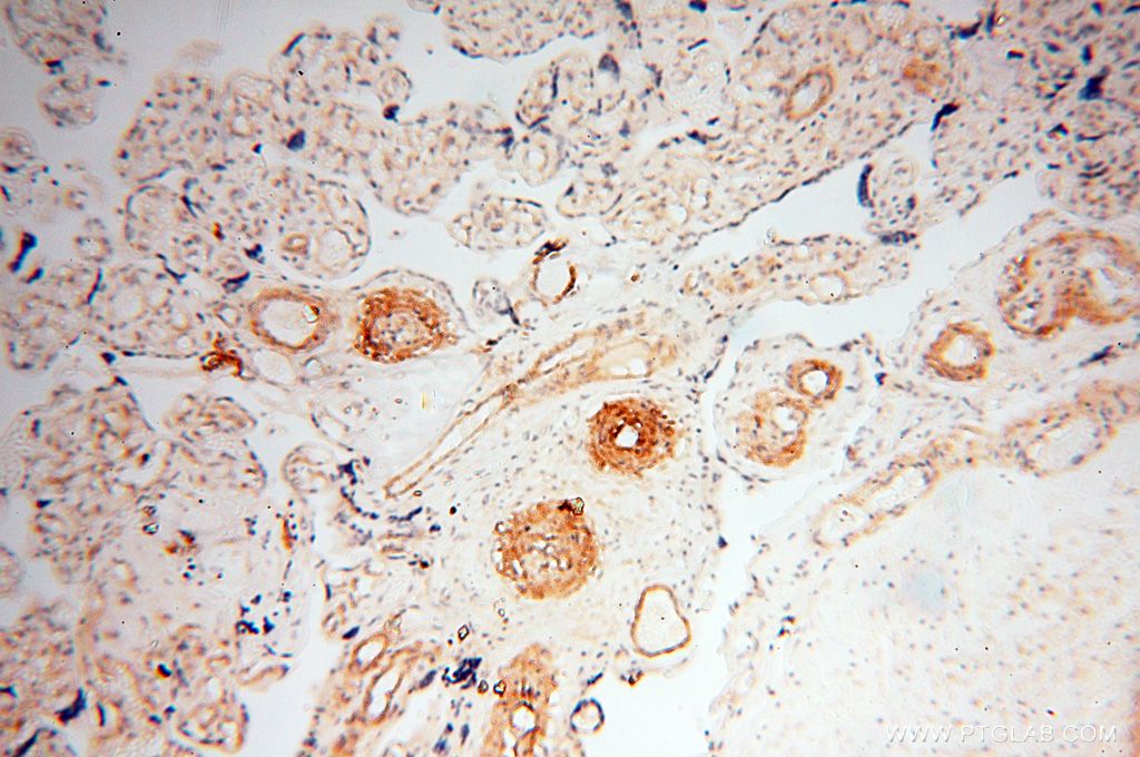 Immunohistochemistry (IHC) staining of human placenta tissue using CD146/MCAM Polyclonal antibody (17564-1-AP)