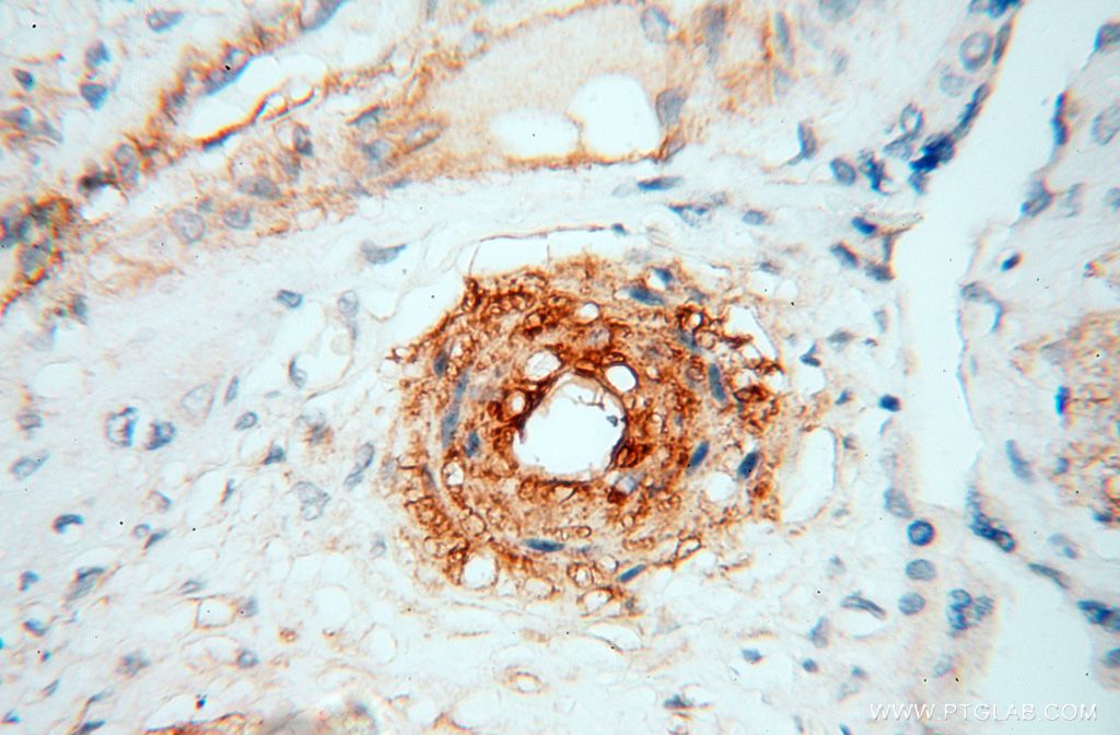 Immunohistochemistry (IHC) staining of human placenta tissue using CD146/MCAM Polyclonal antibody (17564-1-AP)