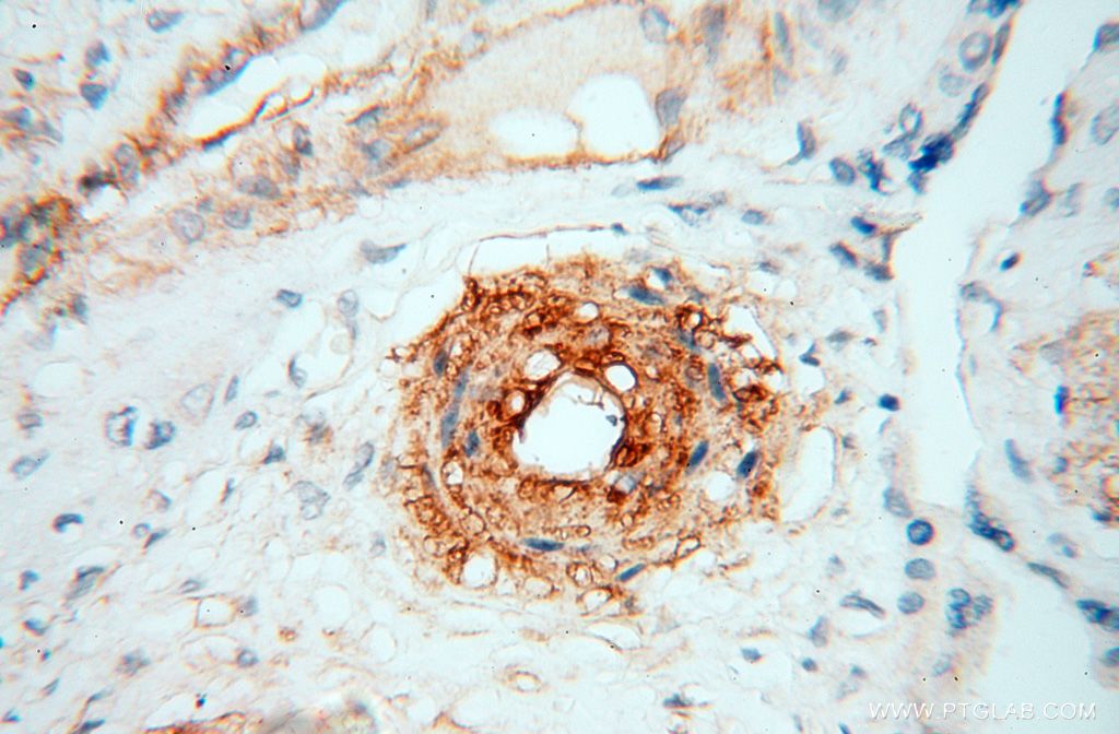 IHC staining of human placenta using 17564-1-AP