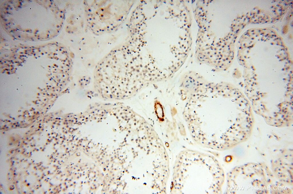 Immunohistochemistry (IHC) staining of human testis tissue using CD146/MCAM Polyclonal antibody (17564-1-AP)