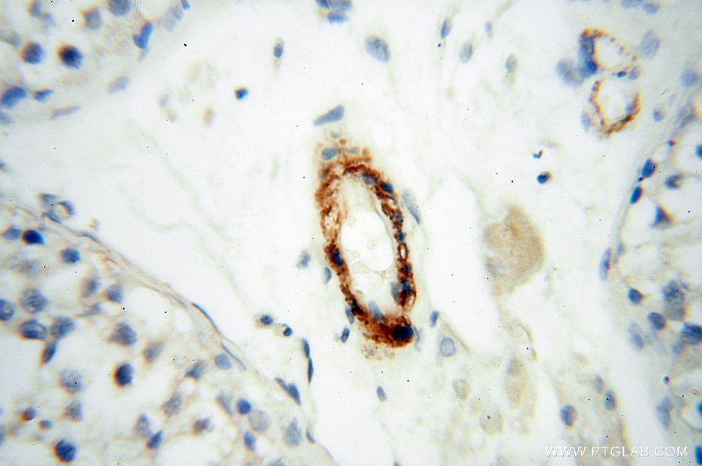 Immunohistochemistry (IHC) staining of human testis tissue using CD146/MCAM Polyclonal antibody (17564-1-AP)