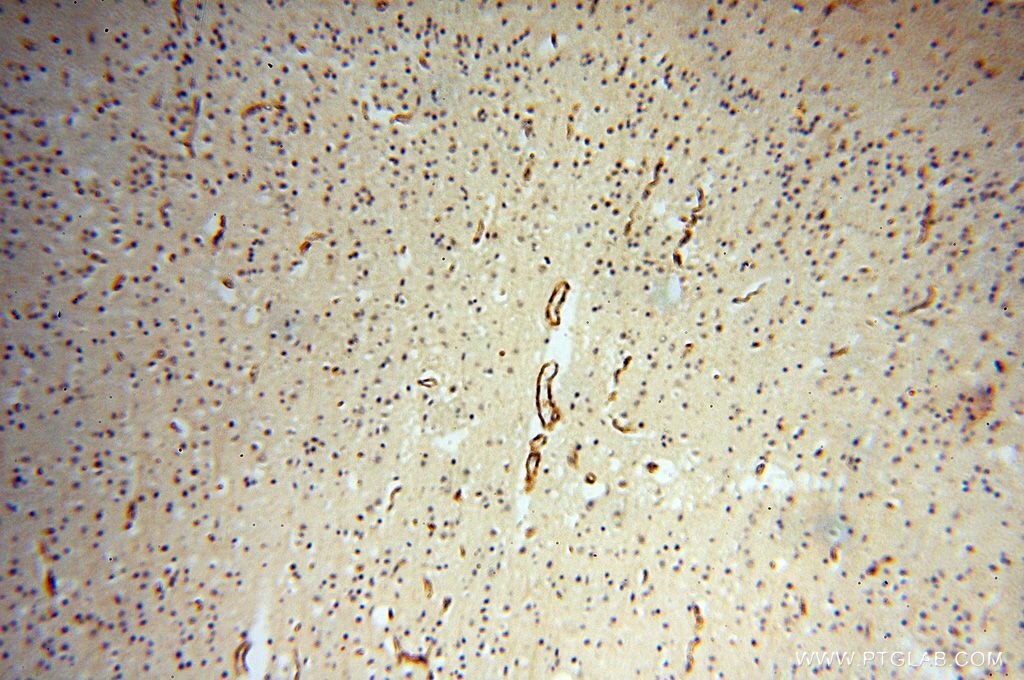 Immunohistochemistry (IHC) staining of human brain tissue using CD146/MCAM Polyclonal antibody (17564-1-AP)