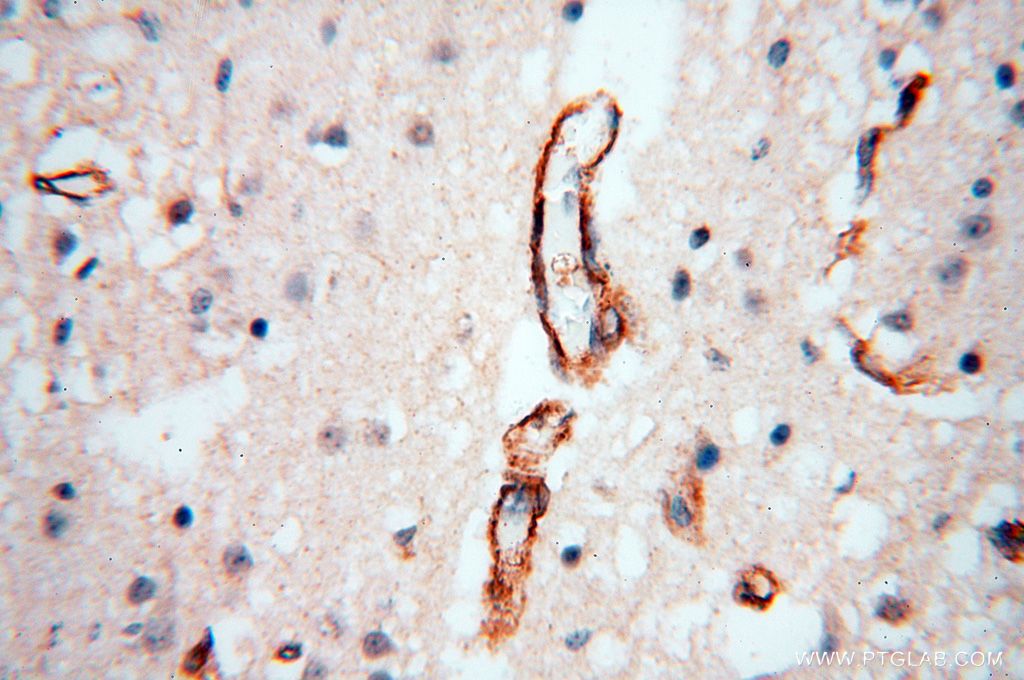 Immunohistochemistry (IHC) staining of human brain tissue using CD146/MCAM Polyclonal antibody (17564-1-AP)