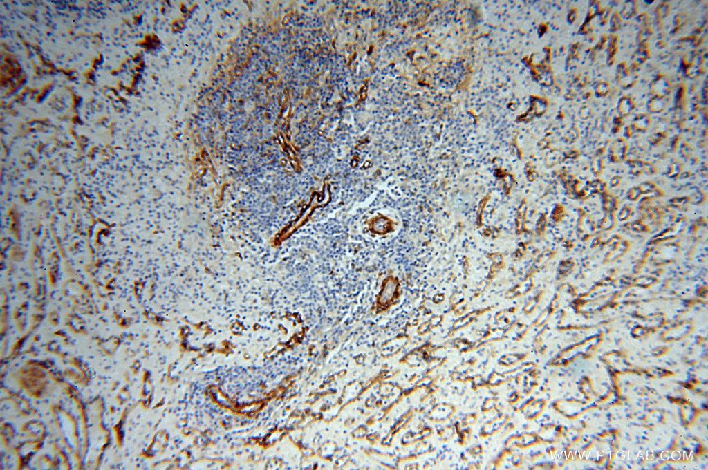 Immunohistochemistry (IHC) staining of human spleen tissue using CD146/MCAM Polyclonal antibody (17564-1-AP)