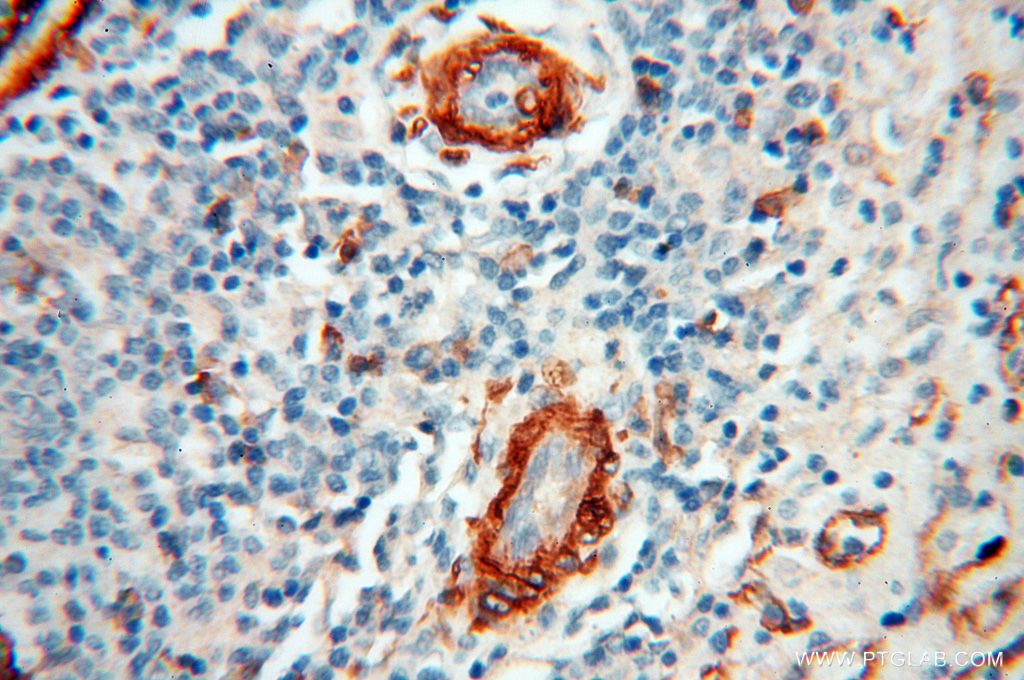 Immunohistochemistry (IHC) staining of human spleen tissue using CD146/MCAM Polyclonal antibody (17564-1-AP)