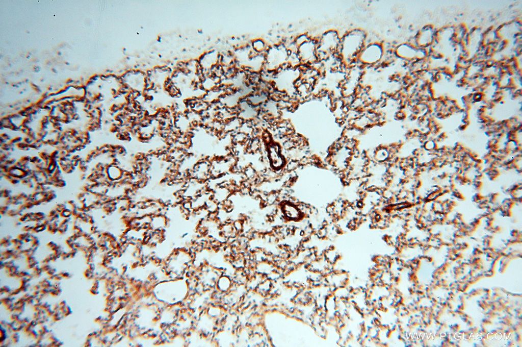 Immunohistochemistry (IHC) staining of human lung tissue using CD146/MCAM Polyclonal antibody (17564-1-AP)