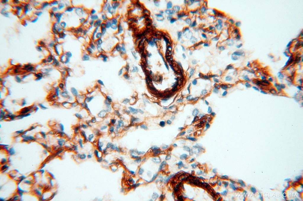 Immunohistochemistry (IHC) staining of human lung tissue using CD146/MCAM Polyclonal antibody (17564-1-AP)