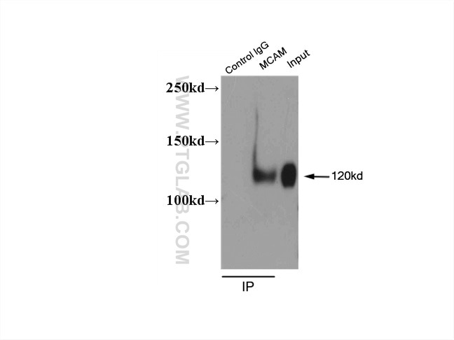 Immunoprecipitation (IP) experiment of HepG2 cells using CD146/MCAM Polyclonal antibody (17564-1-AP)