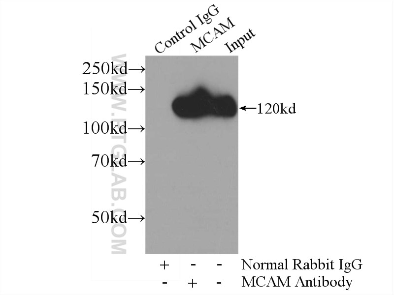 Immunoprecipitation (IP) experiment of HeLa cells using CD146/MCAM Polyclonal antibody (17564-1-AP)