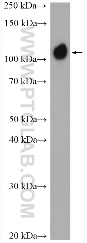 Western Blot (WB) analysis of mouse lung tissue using CD146/MCAM Polyclonal antibody (17564-1-AP)