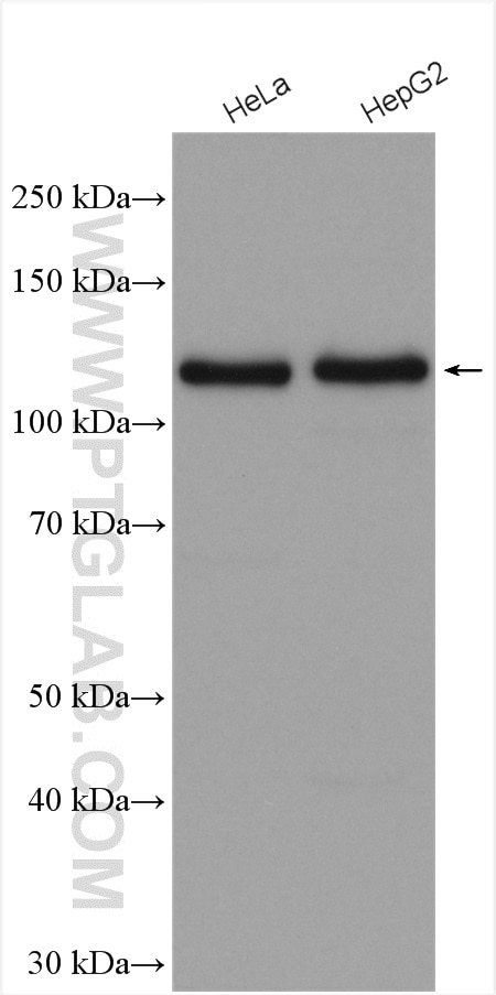 Western Blot (WB) analysis of various lysates using CD146/MCAM Polyclonal antibody (17564-1-AP)