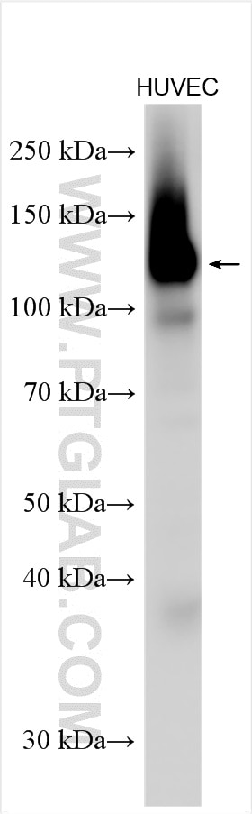 Western Blot (WB) analysis of various lysates using CD146/MCAM Polyclonal antibody (17564-1-AP)