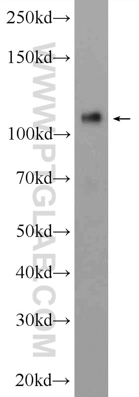 Western Blot (WB) analysis of A375 cells using CD146/MCAM Polyclonal antibody (17564-1-AP)