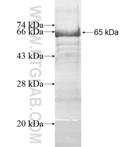 CD146, MCAM fusion protein Ag11762 SDS-PAGE