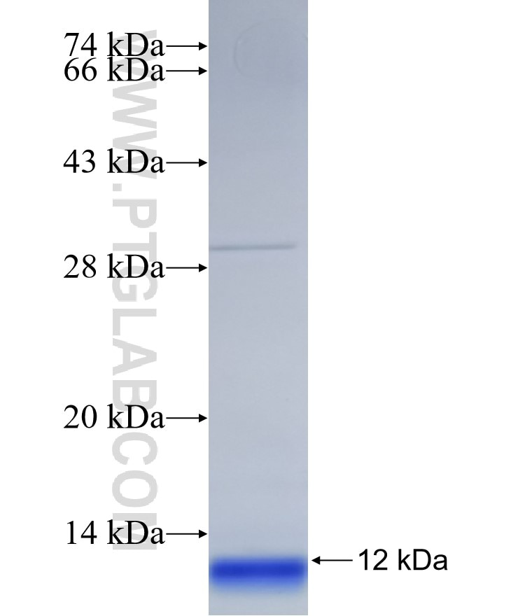 MCART1 fusion protein Ag31357 SDS-PAGE MCART1 fusion protein Ag31357 SDS-PAGE