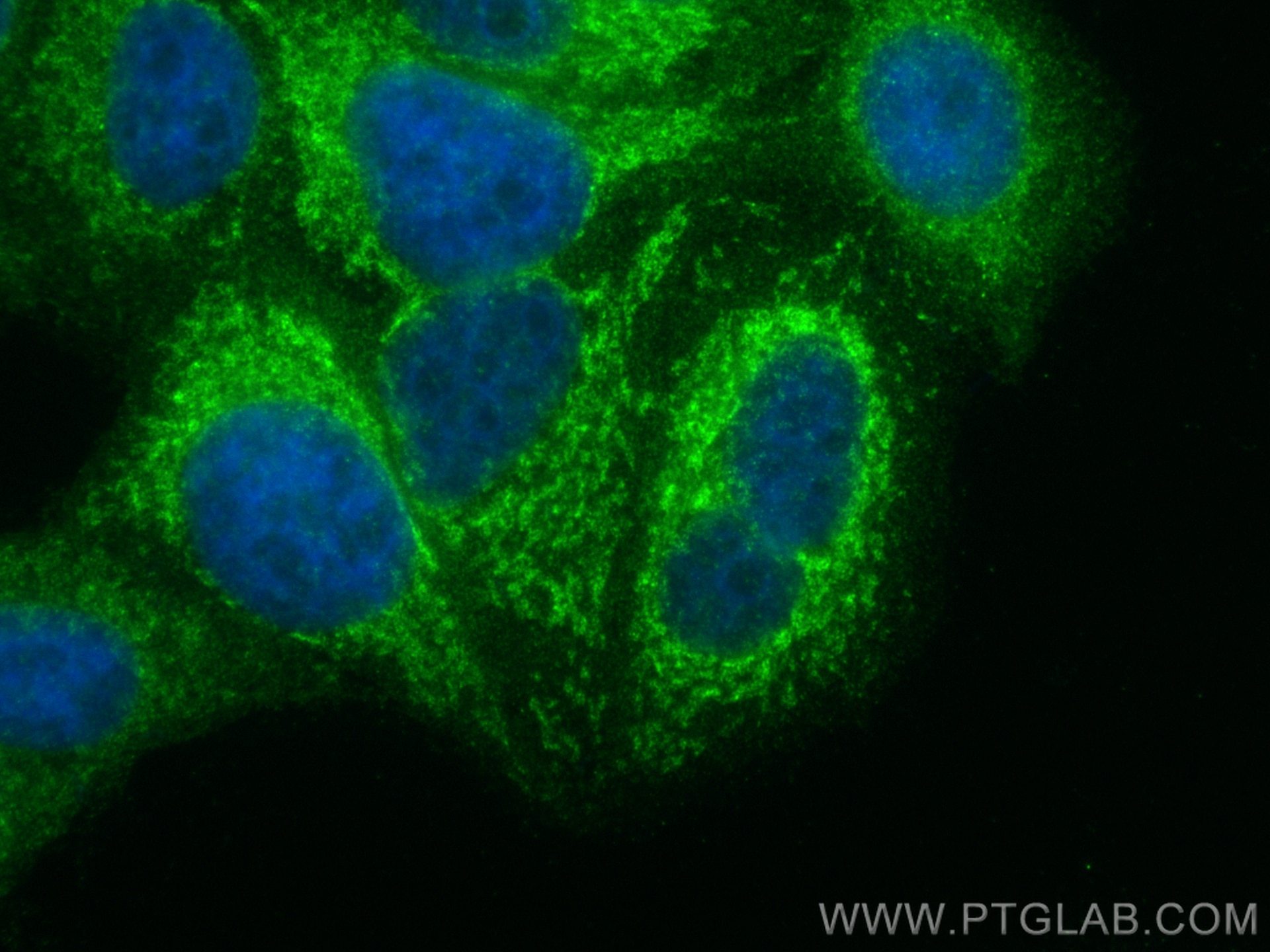 Immunofluorescence (IF) / fluorescent staining of HepG2 cells using MCAT Polyclonal antibody (15536-1-AP)