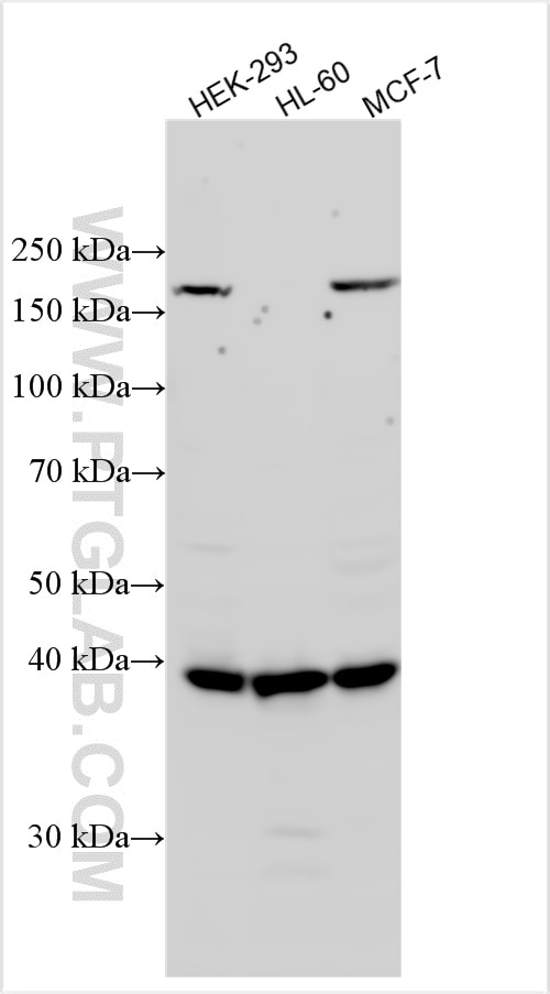 Western Blot (WB) analysis of various lysates using MCAT Polyclonal antibody (15536-1-AP)