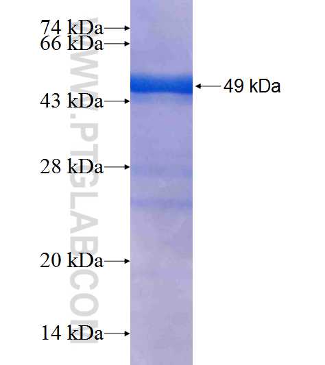MCAT fusion protein Ag7867 SDS-PAGE