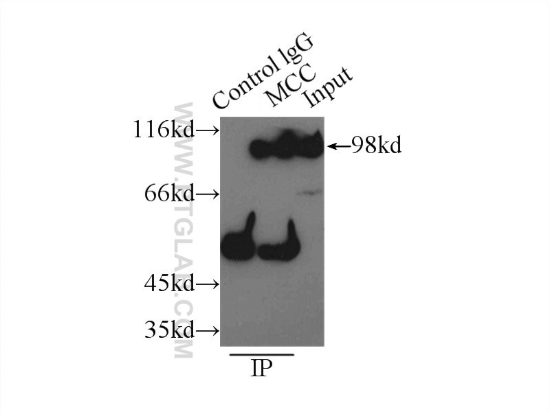 Immunoprecipitation (IP) experiment of PC-3 cells using MCC Polyclonal antibody (11525-1-AP)