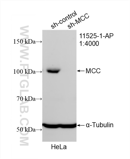 Western Blot (WB) analysis of HeLa cells using MCC Polyclonal antibody (11525-1-AP)