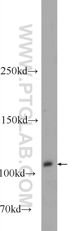 Western Blot (WB) analysis of L02 cells using MCC Polyclonal antibody (11525-1-AP)