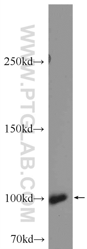 WB analysis of fetal human brain using 11525-1-AP