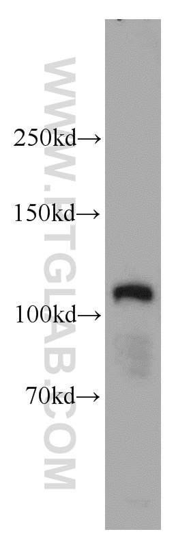 Western Blot (WB) analysis of human brain tissue using MCC Polyclonal antibody (11525-1-AP)