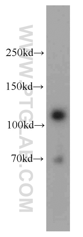 Western Blot (WB) analysis of mouse liver tissue using MCC Polyclonal antibody (11525-1-AP)
