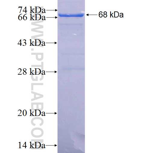 MCC fusion protein Ag2089 SDS-PAGE