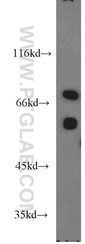 Western Blot (WB) analysis of mouse liver tissue using MCCC1 Polyclonal antibody (14861-1-AP)