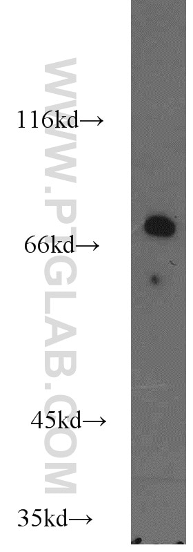 Western Blot (WB) analysis of mouse heart tissue using MCCC1 Polyclonal antibody (14861-1-AP)