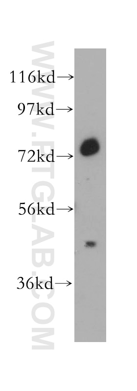Western Blot (WB) analysis of mouse liver tissue using MCCC1 Polyclonal antibody (14861-1-AP)