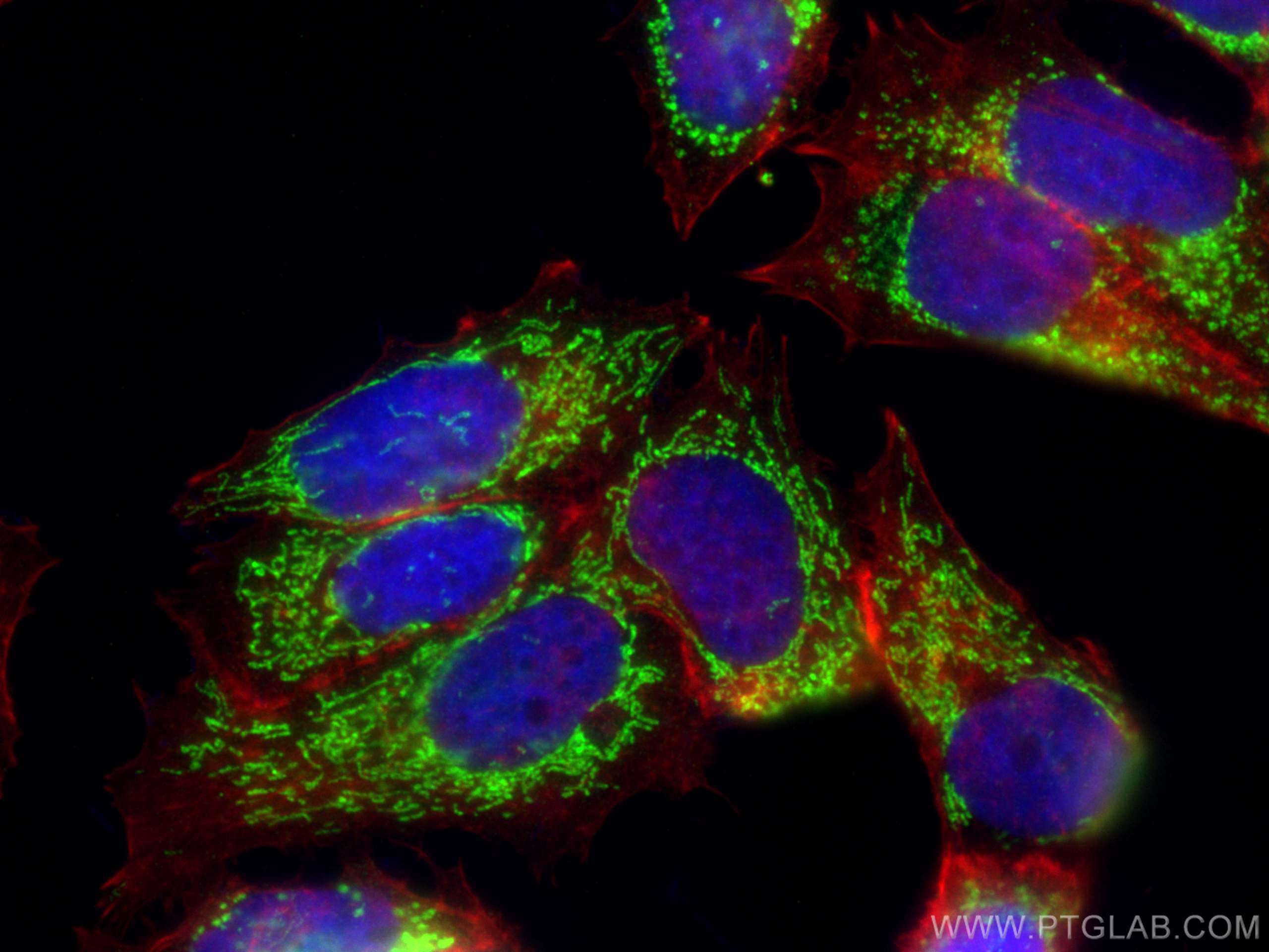 Immunofluorescence (IF) / fluorescent staining of MCF-7 cells using MCCC1 Polyclonal antibody (30081-1-AP)