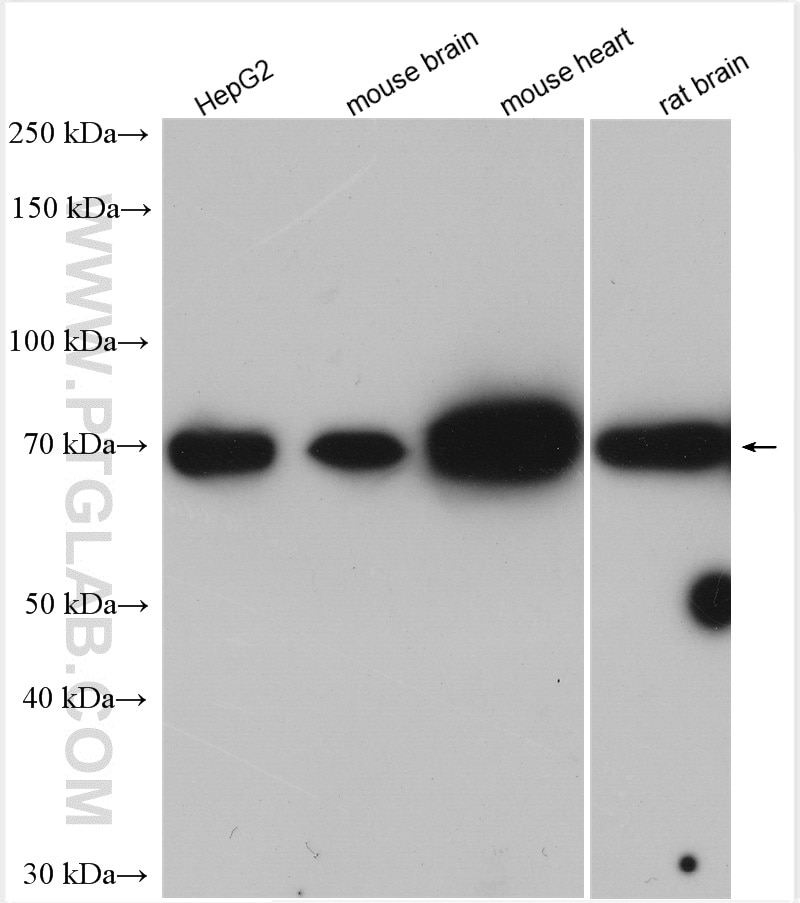 Western Blot (WB) analysis of various lysates using MCCC1 Polyclonal antibody (30081-1-AP)