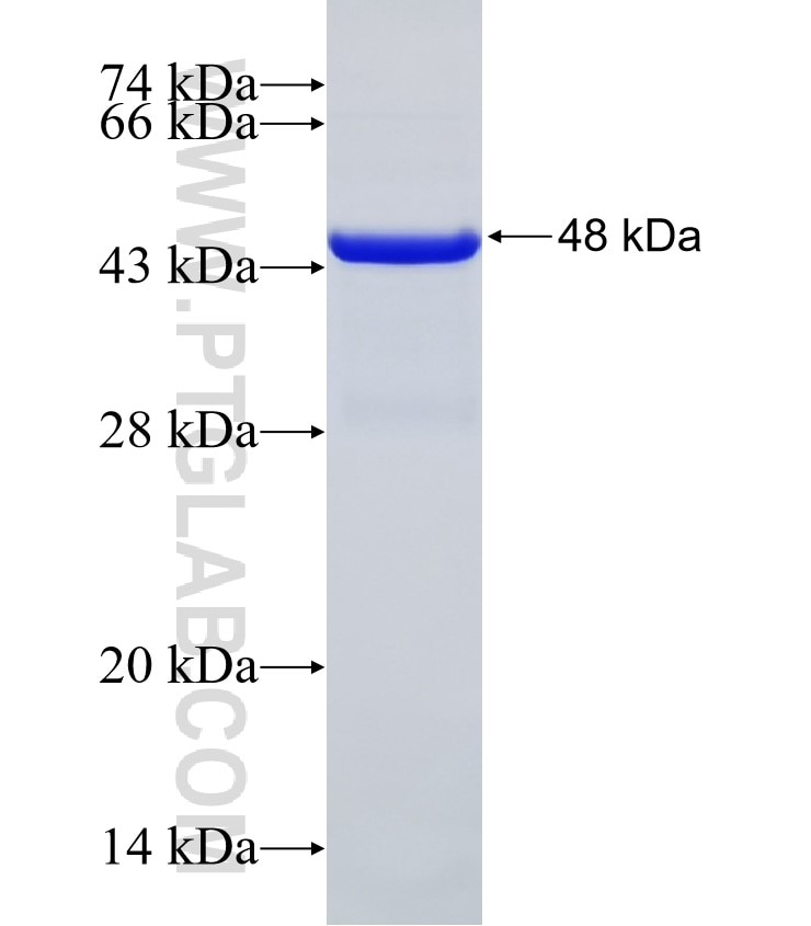 MCCC1 fusion protein Ag32459 SDS-PAGE