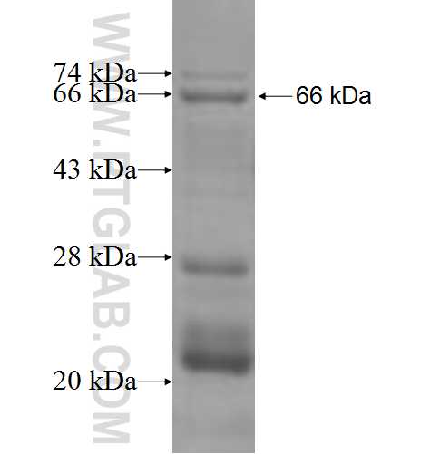 MCCC1 fusion protein Ag6663 SDS-PAGE